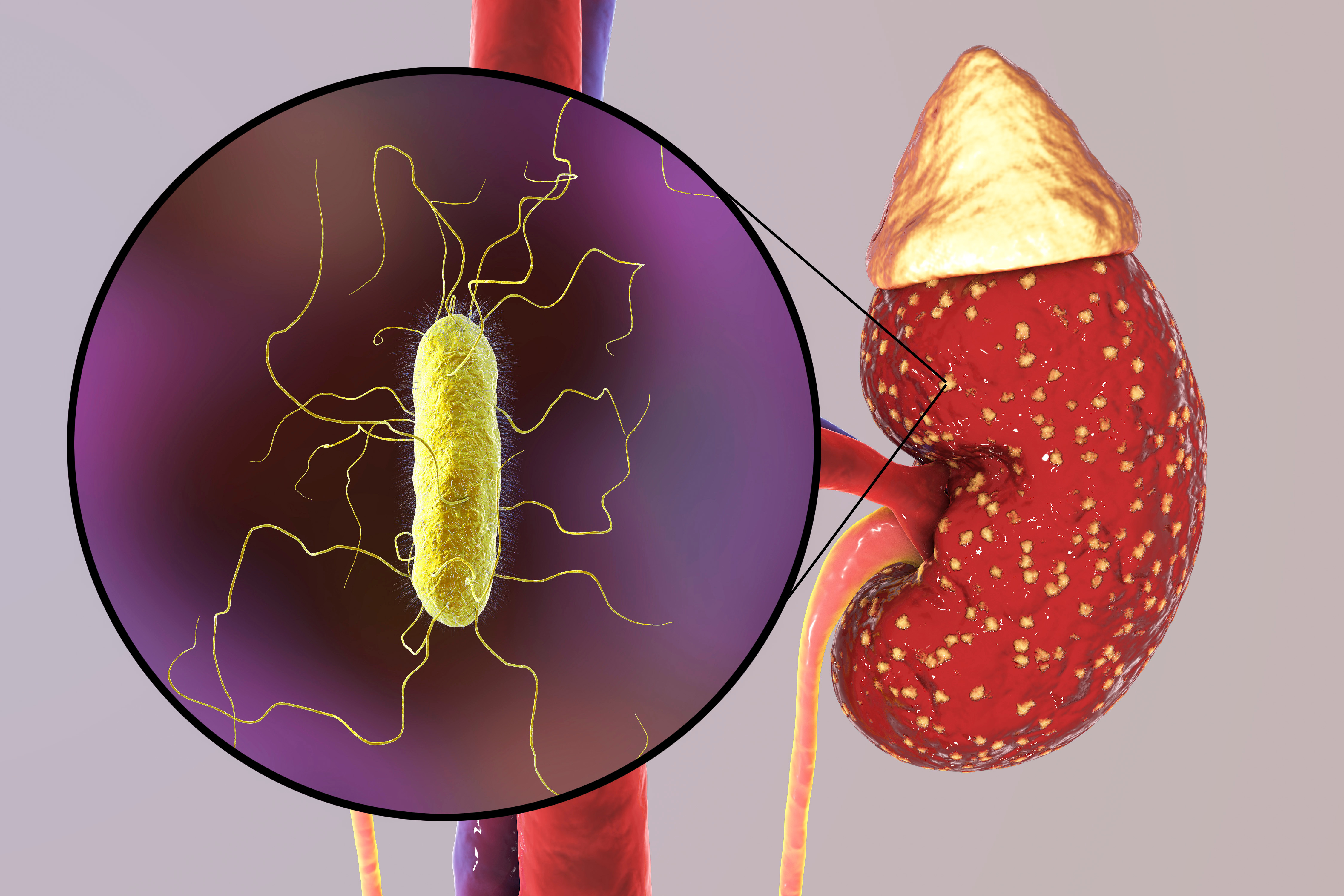 Proteus, Morganella, Providencia.